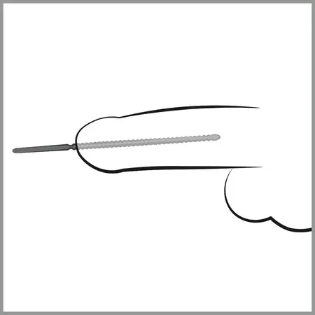 Mystim Dip Stick Ripped 6mm Stainless Steel Urethral Sound 24cm