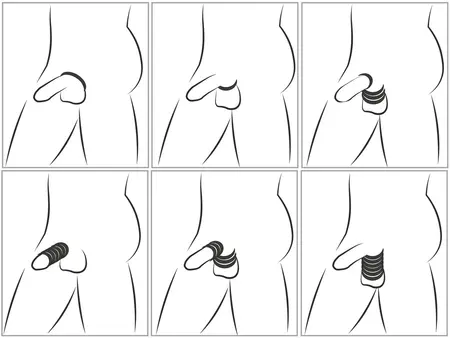 You2Toys Cock&Ball Kit Strong&Stretchy Silicone Ring Set 6 pcs